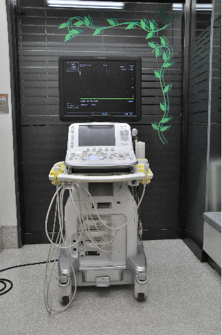 超音波診断装置